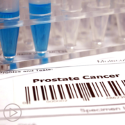 An Update on Prostate Cancer Treatment and Research