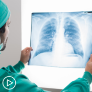 Do Lung Cancer Screening Guidelines Differ for Certain Populations