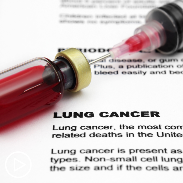 How Do Lung Cancer Patients Benefit From MRD Testing?
