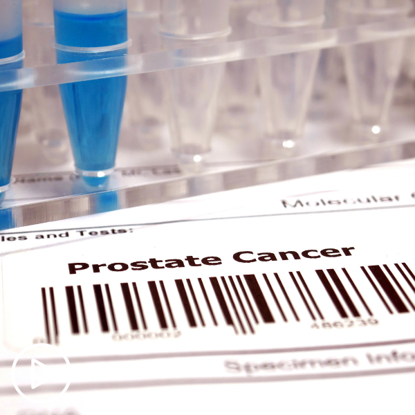 Ask the Prostate Cancer Expert: How Is Prostate Cancer Diagnosis and Treatment Evolving?