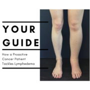 Your Guide: How a Proactive Cancer Patient Tackles Lymphedema