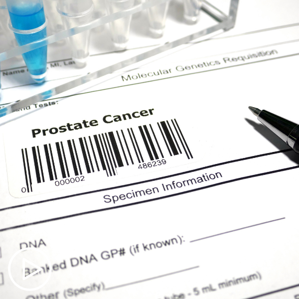 Prostate Cancer Treatment Tools and Advancements