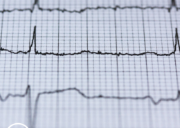 Understanding What ECG Monitoring Tools Mean for MPN Patients
