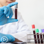 What Should You Ask Your Doctor About Myeloma Testing_