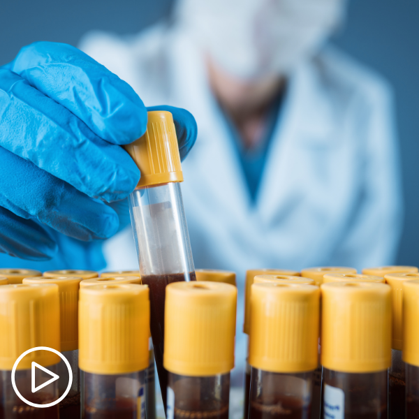 What Standard Testing Follows a Myeloma Diagnosis_ (1)