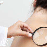 Advanced Non-Melanoma Skin Cancer Treatment Decisions What’s Right for You