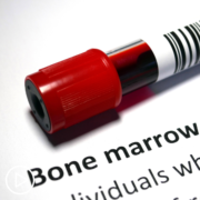 Do AML Bone Marrow Biopsies Show Racial and Ethnic Variances?