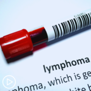 Follicular Lymphoma Disease Transformation and Secondary Cancer Risk