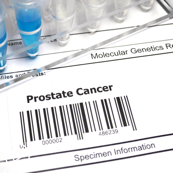 How Can Prostate Cancer Stigmas and Misconceptions Be Addressed