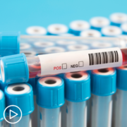 How Do Myeloma Test Results Influence Prognosis and Care?