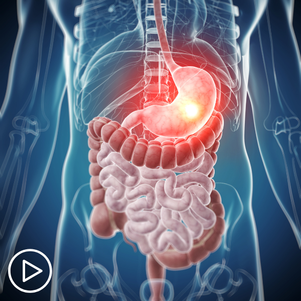 An Overview of Current Gastric Cancer Treatment Options