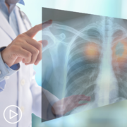 Lung Cancer Treatment Decisions: What’s Right for You?