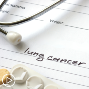Small Cell Lung Cancer Clinical Trials and DeLLphi Study Update