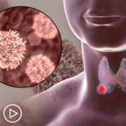 Thyroid Cancer Explained: Types, Staging, and Patient Communication