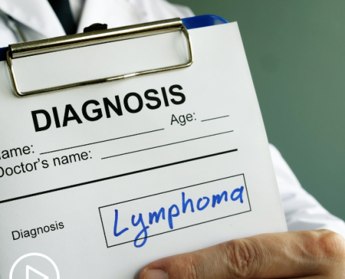 Understanding Diffuse Large B-cell Lymphoma (DLBCL) and Its Subtypes