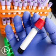 Understanding Myeloma Testing and Monitoring | An Overview