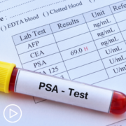 Understanding Recommended PSA Screening Age and Frequency In Prostate Cancer