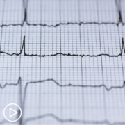 Understanding What ECG Monitoring Tools Mean for MPN Patients