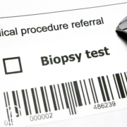 What Can I Expect During a Bone Marrow Biopsy
