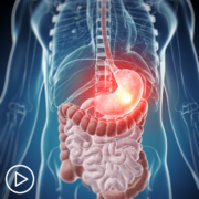 What Is Gastric Cancer?
