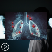What Is the Difference Between Small Cell and Non-Small Cell Lung Cancer?