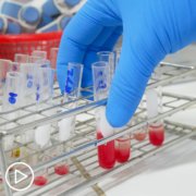What Tests Are Essential to Understand a Myeloma Diagnosis?