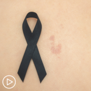 When Should Clinical Trials Be Considered for Advanced Non-Melanoma Skin Cancer Treatment?
