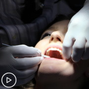 Why Should Myeloma Patients Visit the Dentist Frequently